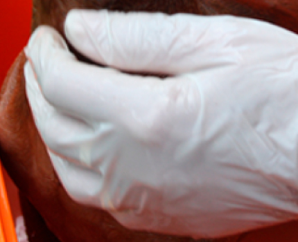 Hiero neste huolellisesti turkkiin niin, että aine pääsee kosketukseen ihon kanssa.